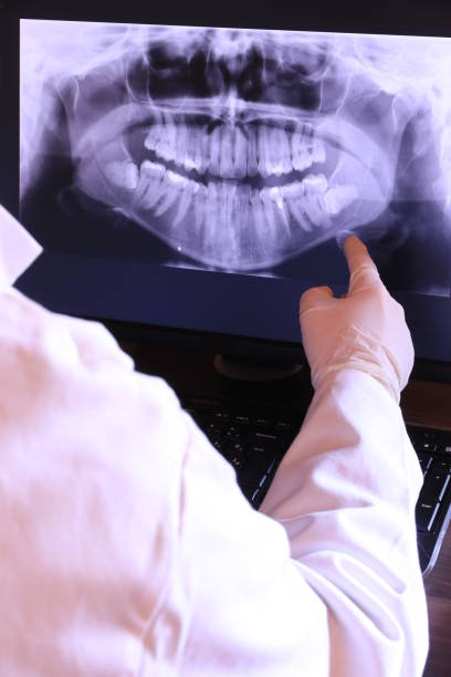 Best Emergency Broken Tooth Repair in Beacon, NY